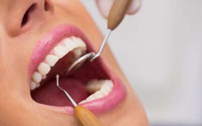 ¿Necesitamos todos nuestros dientes?